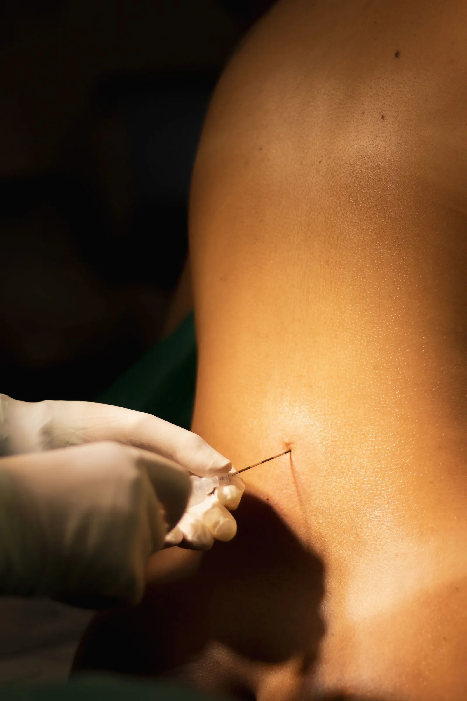Body Contouring